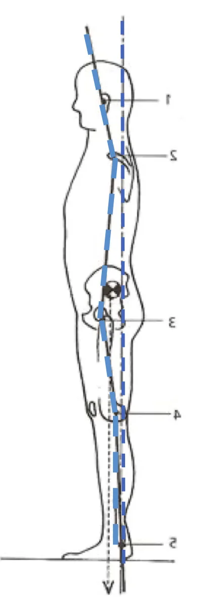 Postural alignment